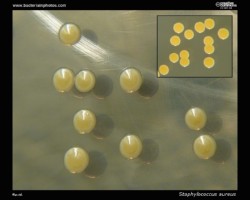 yellow pigmented colonies of s.aureus on tryptic soy agar